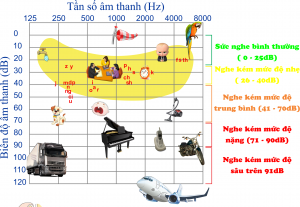 Mức độ giảm thính lực